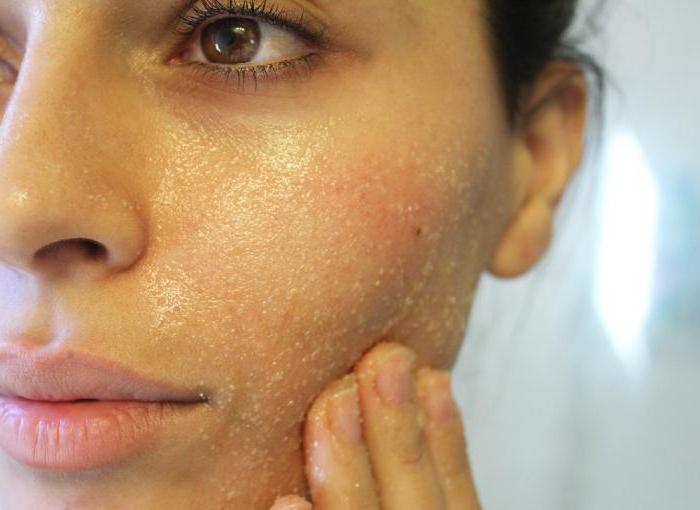 Домашний скраб для лица из соды